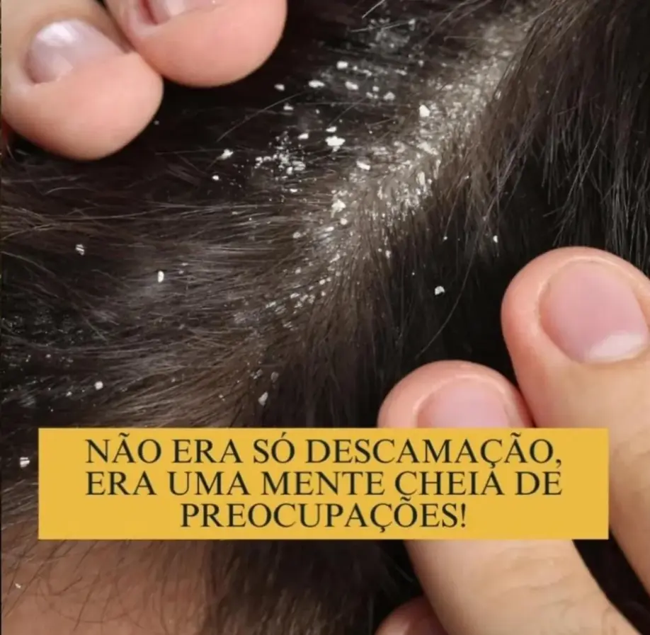 Avaliação de descamação do couro cabeludo